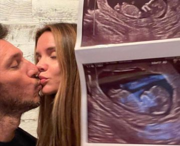 Pico Mónaco y Diana Arnopoulos mostraron la pancita y ecografías para oficializar el embarazo
